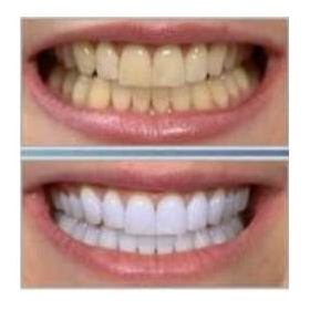 dientes-blancos-dientes.jpg